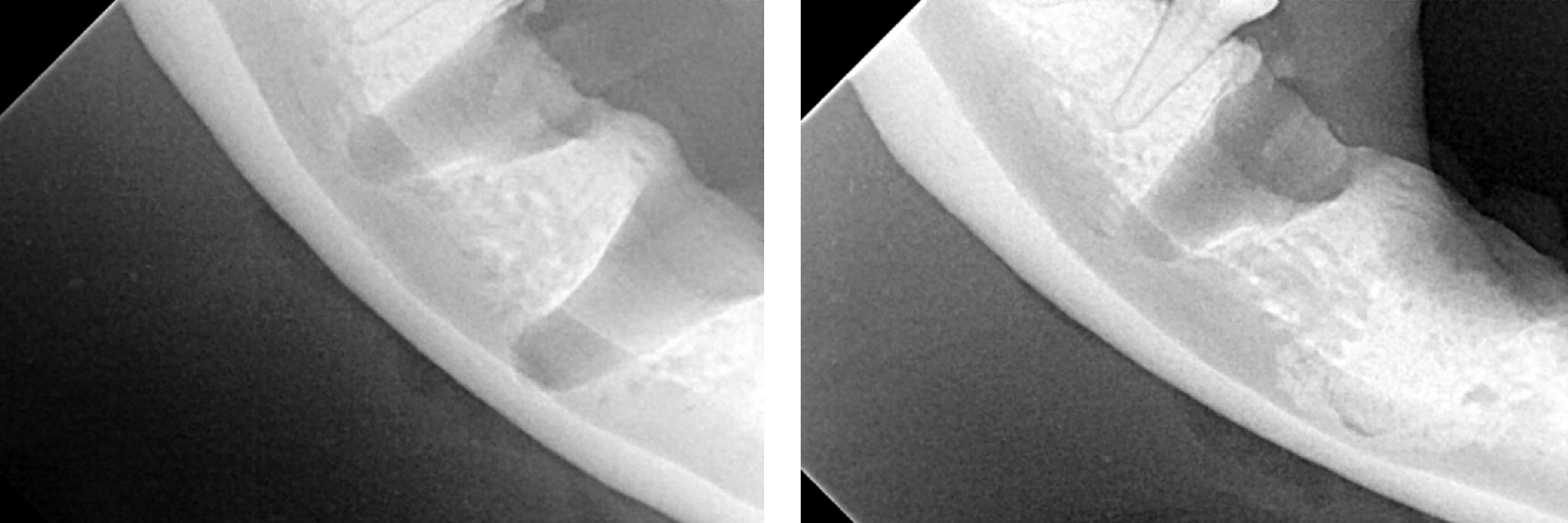 Left - Radiograph After Extraction