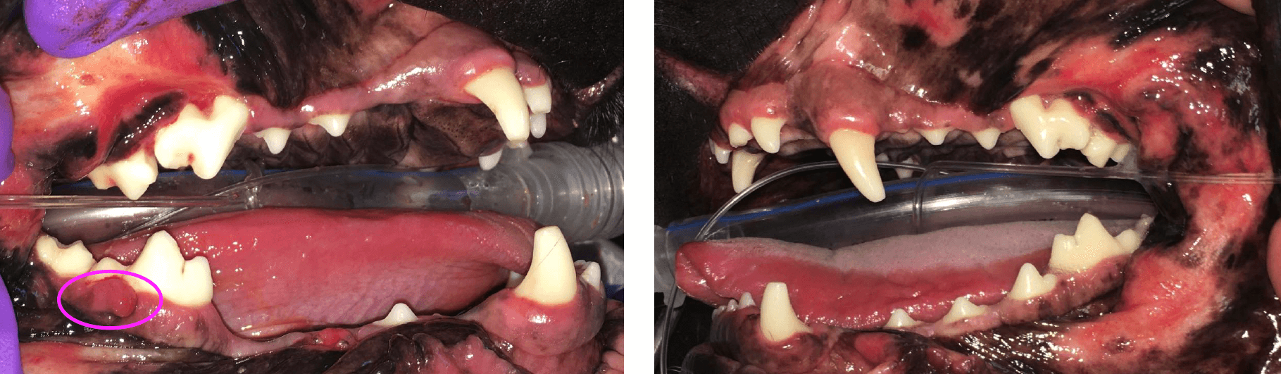 BEFORE extraction highlighting sites of gingival contouring