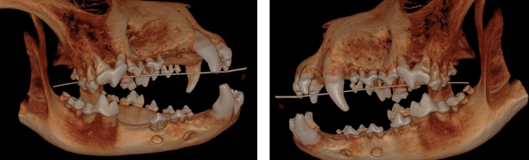 Hard tissue 3D reconstruction using CBCT