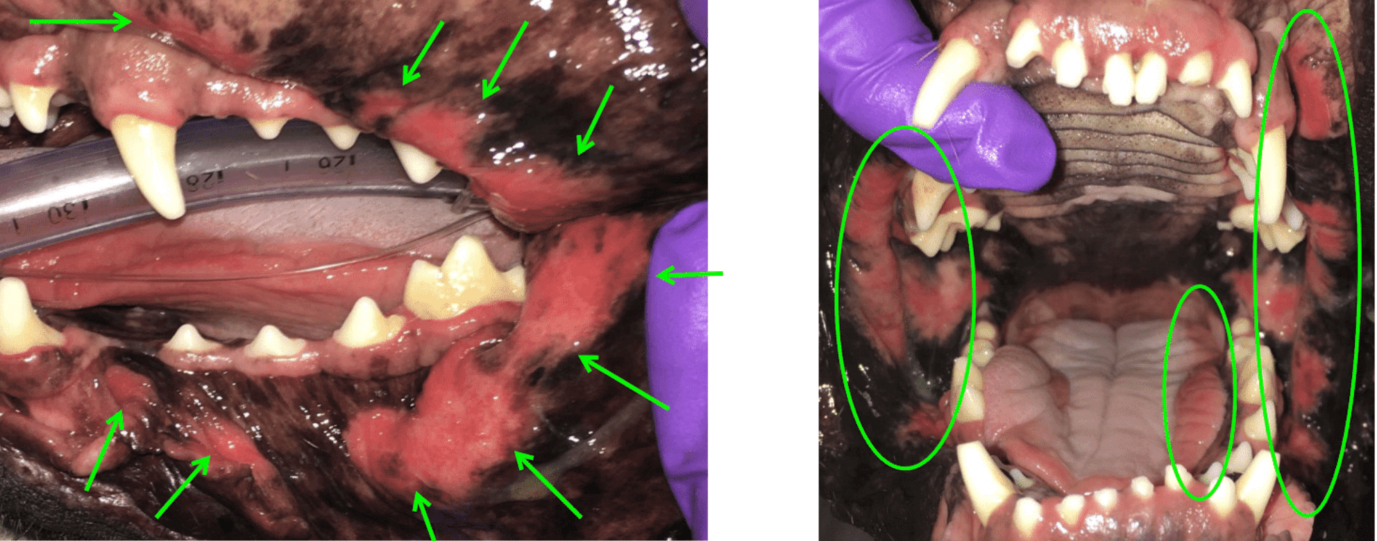 Images showing -kissing lesions- 1 2