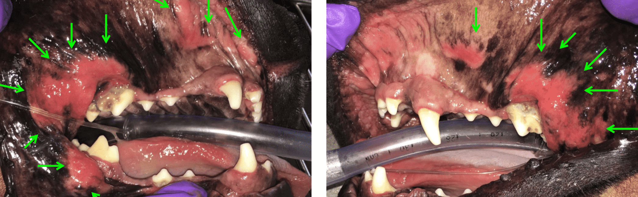 Images showing -kissing lesions- 2