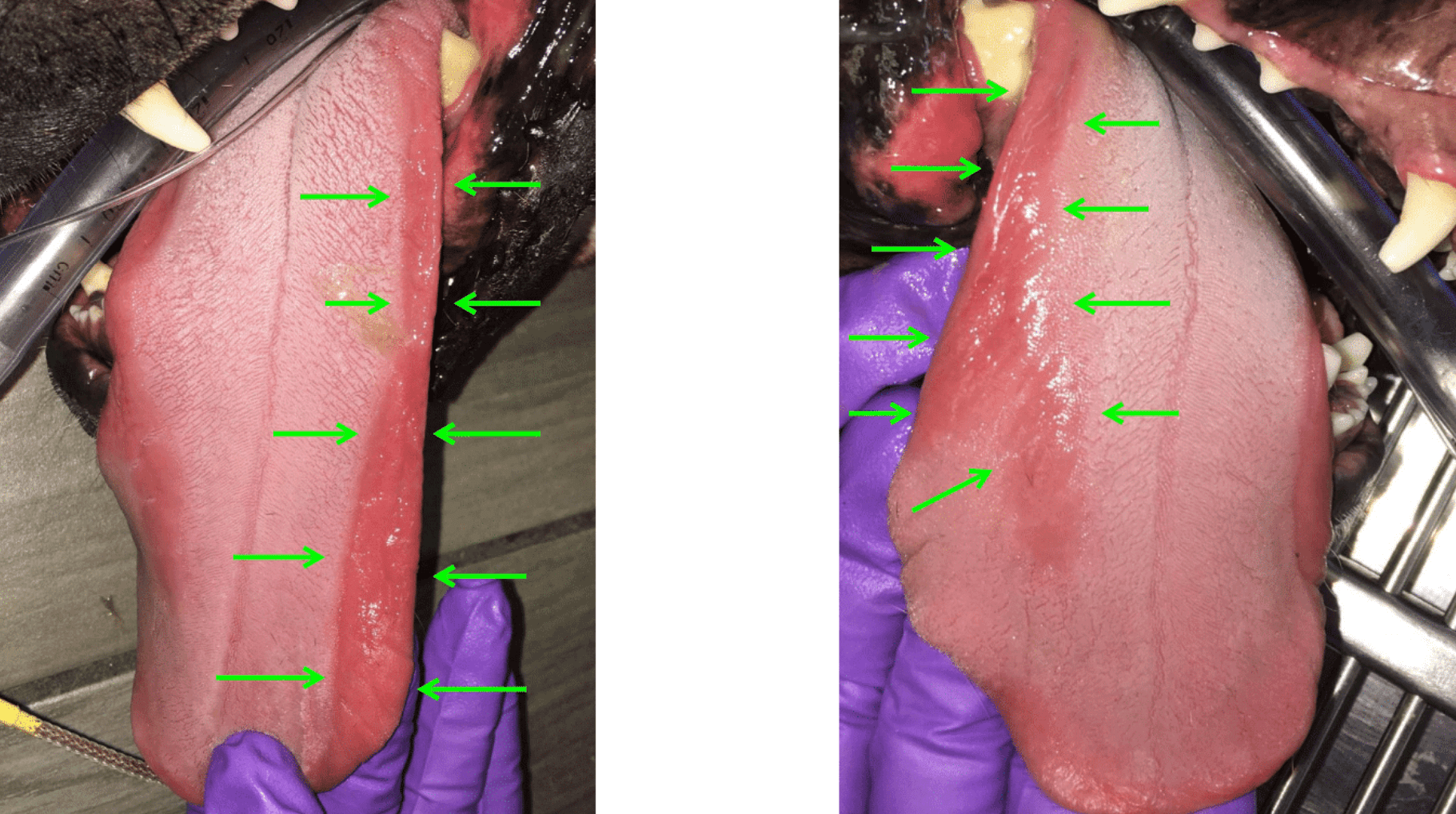 Images showing -kissing lesions- on tongue 1