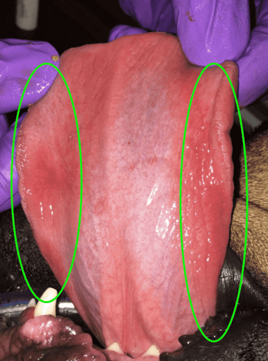 Images showing -kissing lesions- on tongue 2