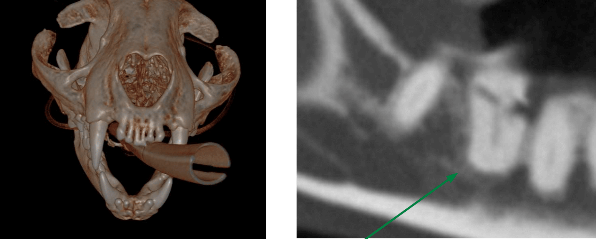 LEFT - front - CT RIGHT - CT of broken root - extracted