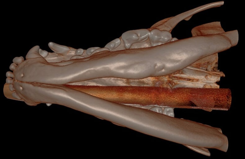 Follow Up - 3D Hard Tissue Overview ventral aspect