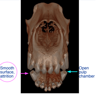 3D image of Attrition vs open pulp chamber