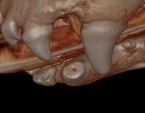 3D image of open pulp chamber