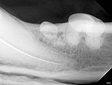 Radiograph showing working length during RCT