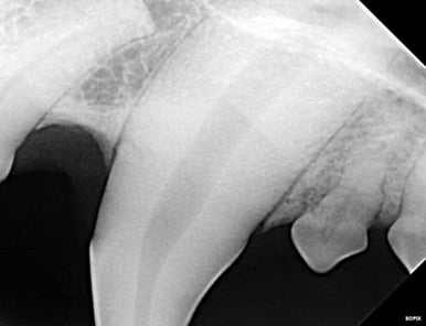 radiograph before RCT - access point