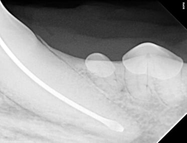 Master file during RCT 