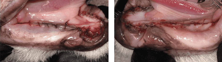 After extractions - Lower jaw (mandible)-2