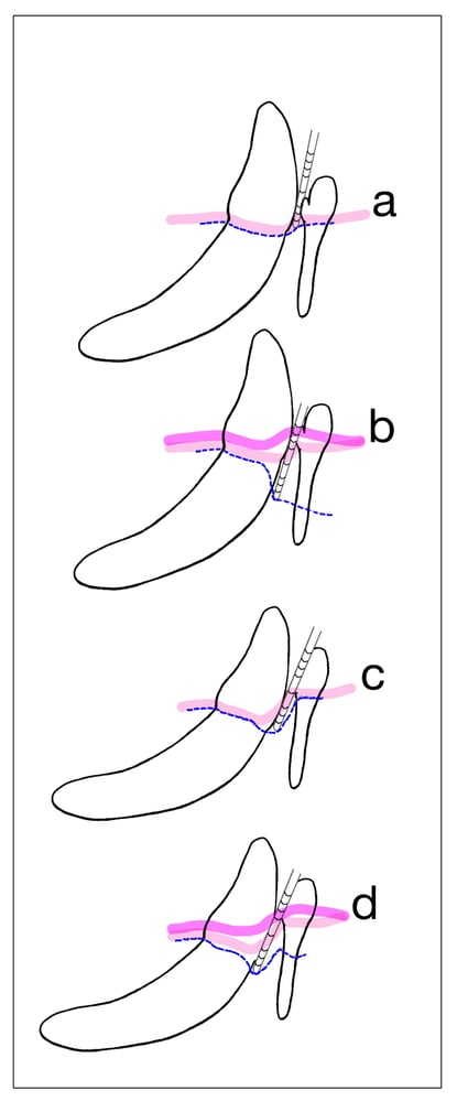 Figure 1 final-2 Figure 1 final-2