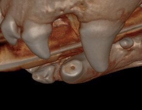 Worn Teeth May Need Root Canal Therapy